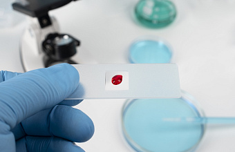 ВИЧ-инфекция и СПИД: периоды заболевания